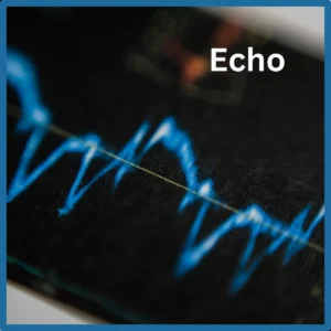 Sound waves show on a black screen with the word “echo” written above. 