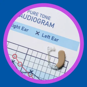 An audiogram shows mild hearing loss. 